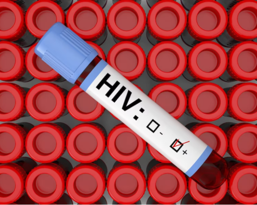 HIV